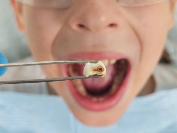Best Emergency Gum Treatment in Warm Springs, OR